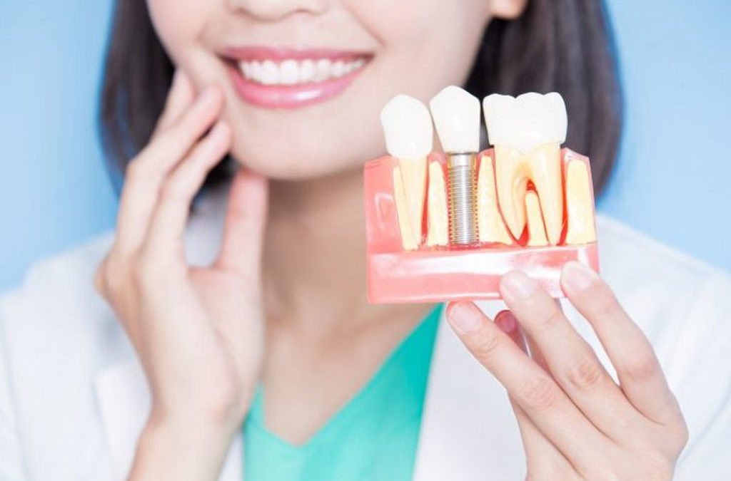 5 Great Reasons to Restore Your Smile with Dental Implants