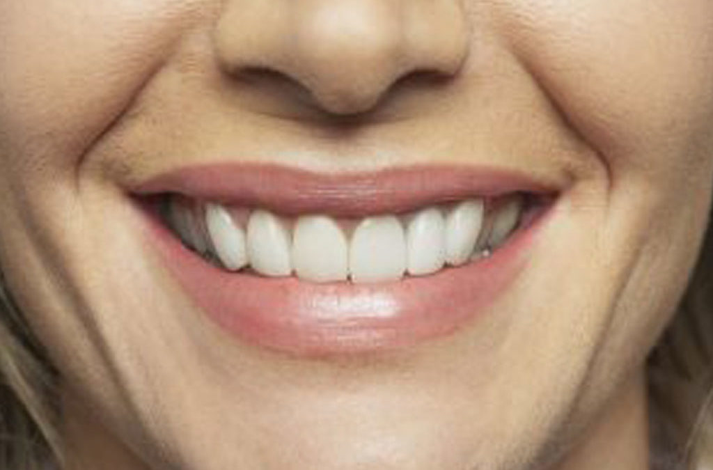 Looking for a Smile Makeover? Your Cosmetic Dentist in Canton Can Help
