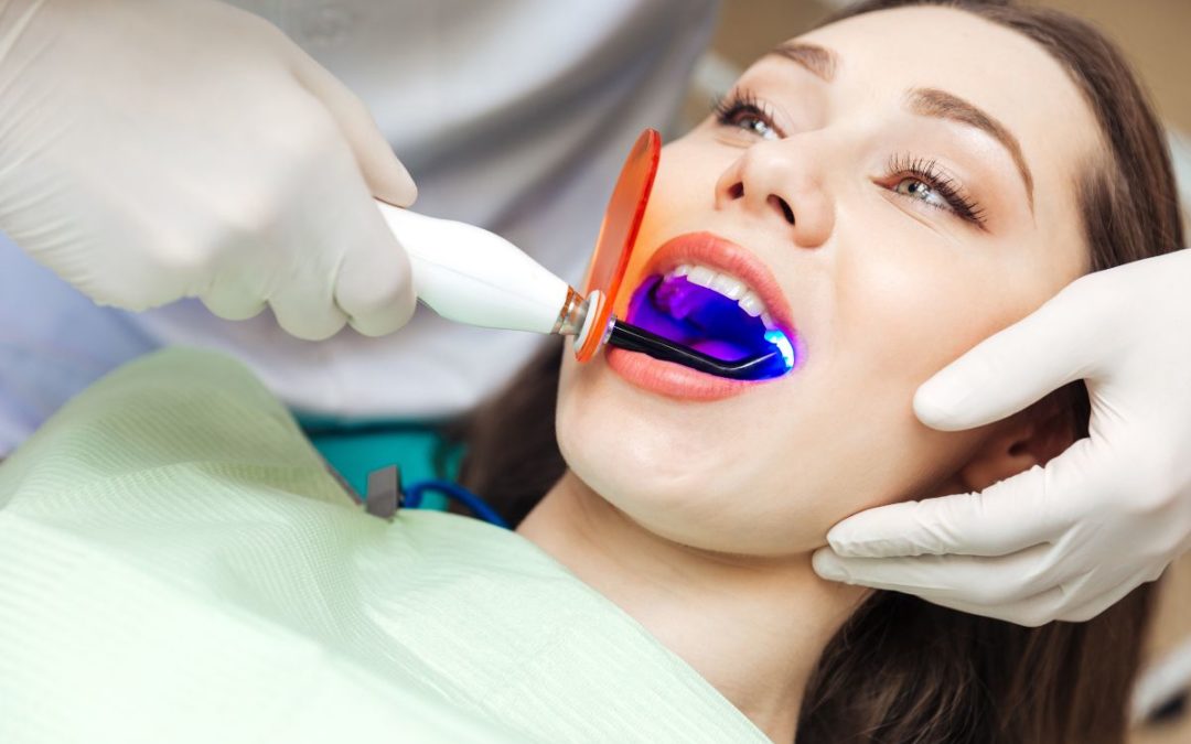 Which Whitening Treatment is Best?